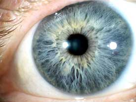 iridology: the study of the iris
