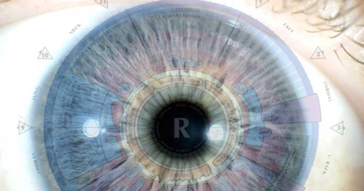 Iridology